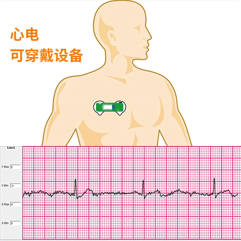 BMD101 ECG Electrocardiogram S - Ecg Patch Monitor recension och pris